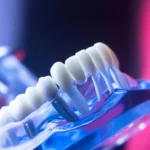 Implanty zębowe Szczecin cena
